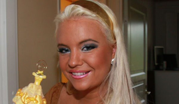 Plastic Surgery Turns a Pretty Woman into a Monster (21 pics)