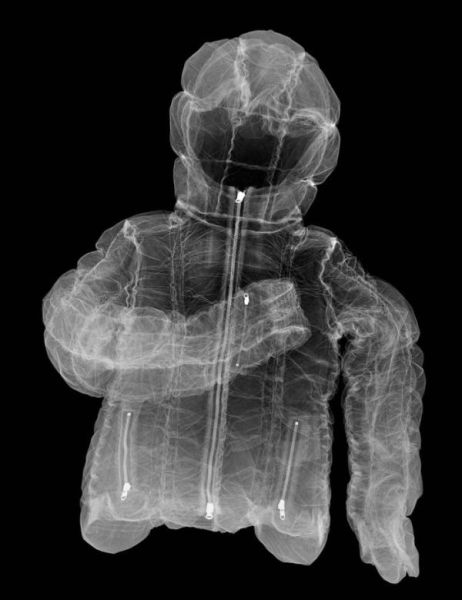 Cool X-Ray Pictures (15 pics)