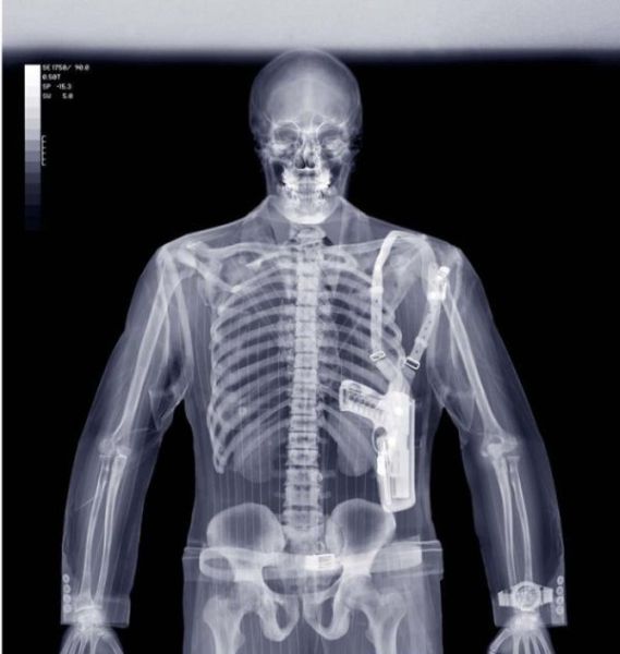 Cool X-Ray Pictures (15 pics)