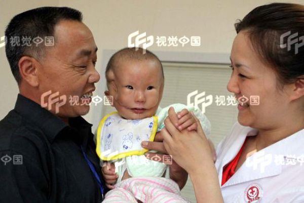 Chinese Boy Born with a Mask-Like Face (5 pics)
