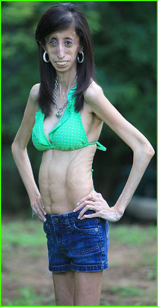 21-Year Old Woman Needs to Eat 60 Meals a Day! (17 pics)