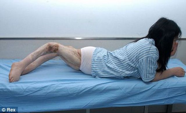 Car Accident Twisted Girl’s Legs (4 pics)