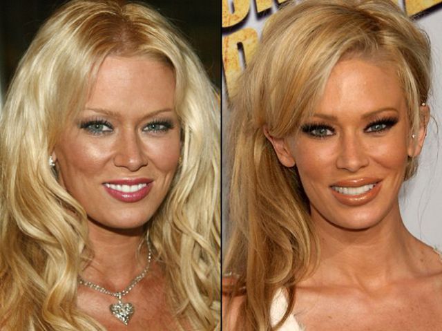 Plastic Surgery and Celebrities (21 pics)