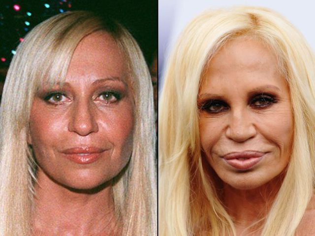 Plastic Surgery and Celebrities (21 pics)