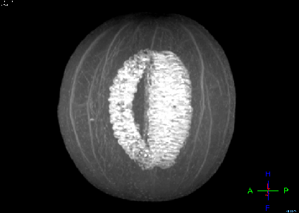 Looking Inside Fruits and Vegetables Using a Radiology Method (17 gifs)