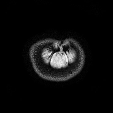 Looking Inside Fruits and Vegetables Using a Radiology Method (17 gifs)