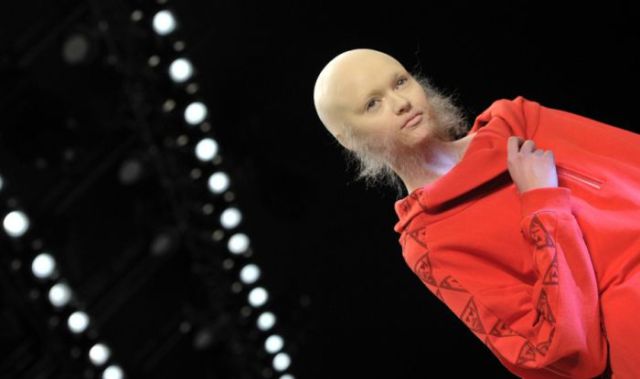 Shocking Bald Models on the Catwalk (14 pics)