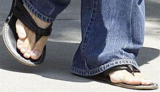 Famous Women with Ugly Feet (21 pics) - Izismile.com