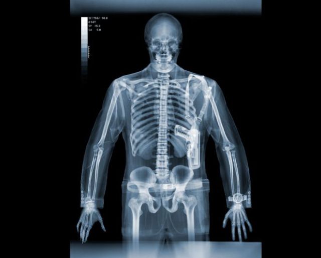 xray vision pictures