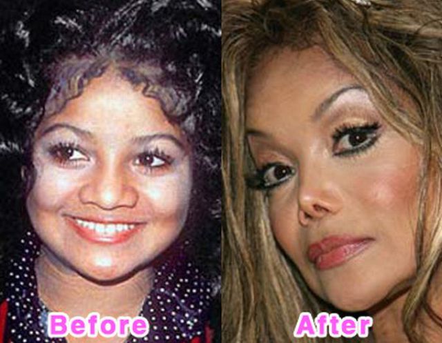 Celebrity Plastic Surgery Before and After Photos (16 pics) .