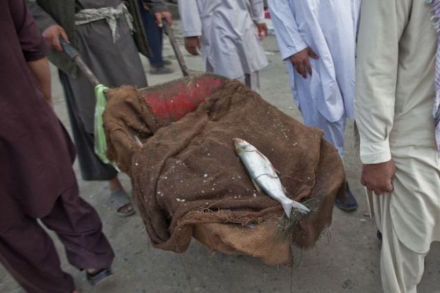 The Scars of Afghanistan (22 pics)