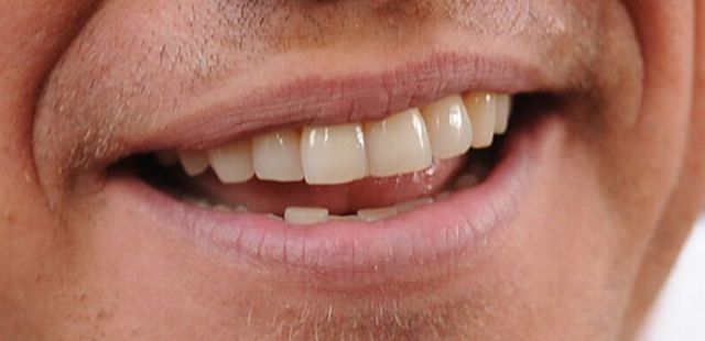 Guess Who: Celebrity Smiles (20 pics)