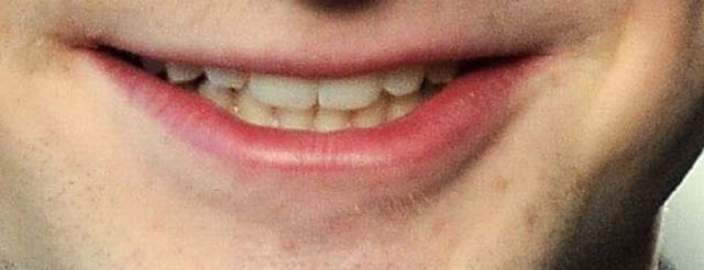 Guess Who: Celebrity Smiles (20 pics)