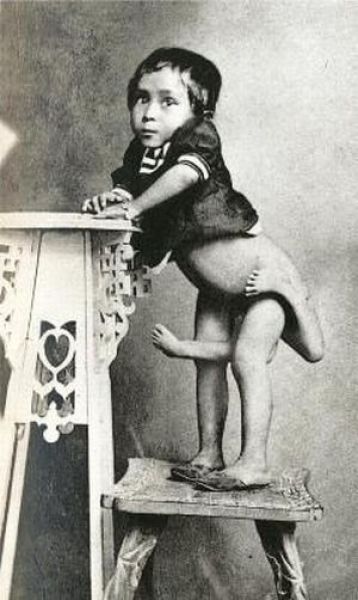 Circus Freaks from Back Then (25 pics)