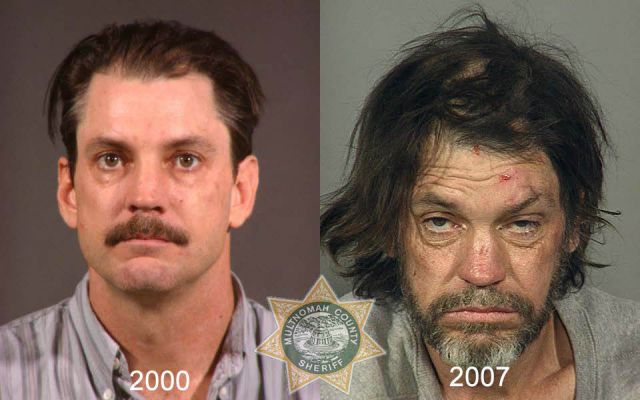 Shocking Mug Shots of Meth Addicts