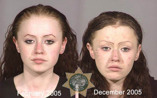 Shocking Mug Shots of Meth Addicts