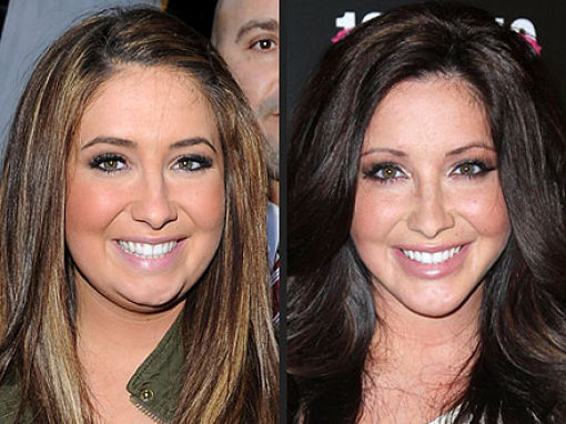 Eye On Stars: The Bristol Palin Plastic Surgery Debate Rages On And Other Hollywood News