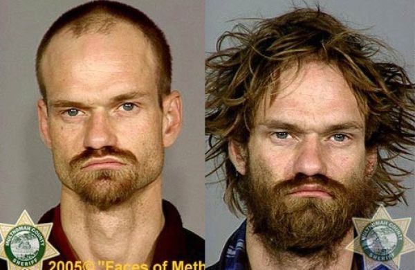 Meth Addicts: Before and After (38 pics) - Izismile.com