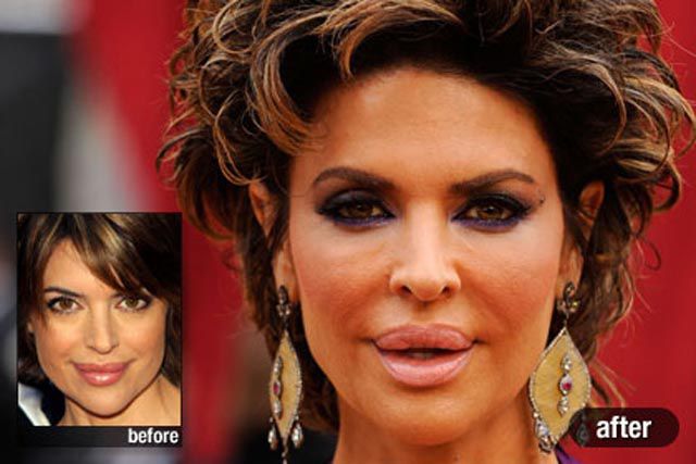 Plastic Surgery on the Red Carpet
