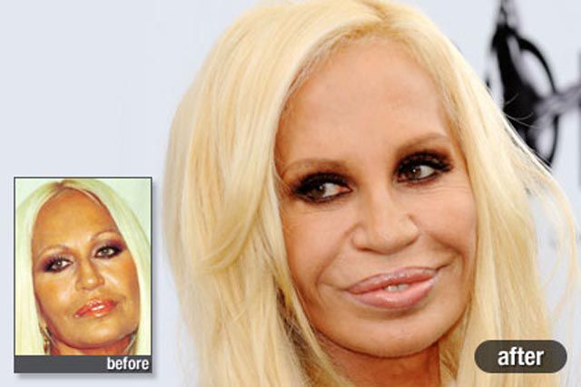 Plastic Surgery on the Red Carpet