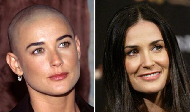 How Do You Like Them Best: Bald or with Hair?