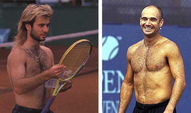 How Do You Like Them Best: Bald or with Hair?