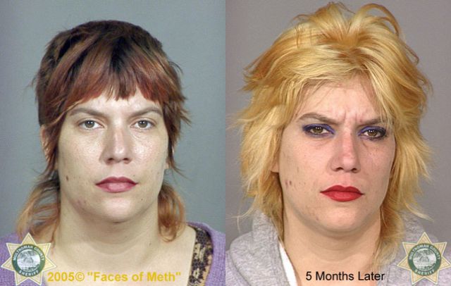 Faces of Meth