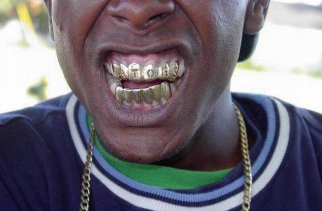 Would You Wear Gangsta Grillz? (13 pics) - Picture #3 - Izismile.com Can You Get A Grill With No Teeth