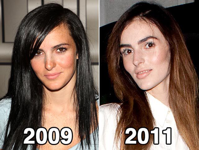 The Frightening New Face of Ali Lohan