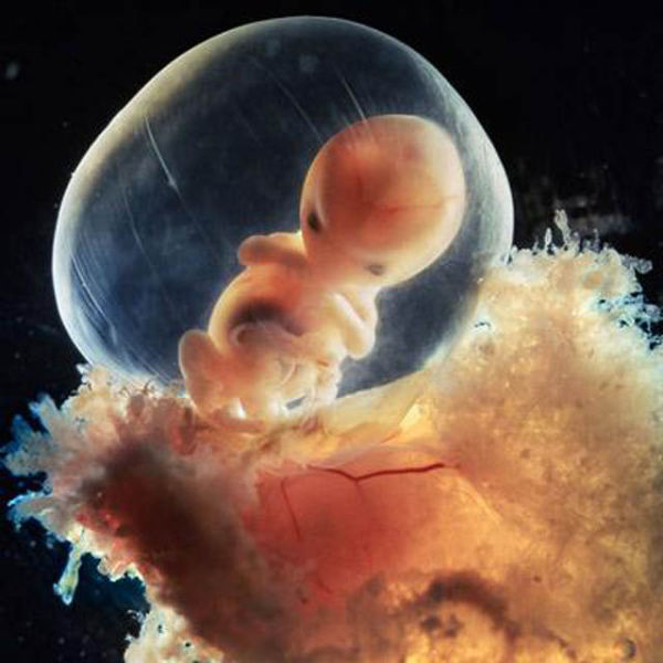 Incredible Photos: A Child is Born