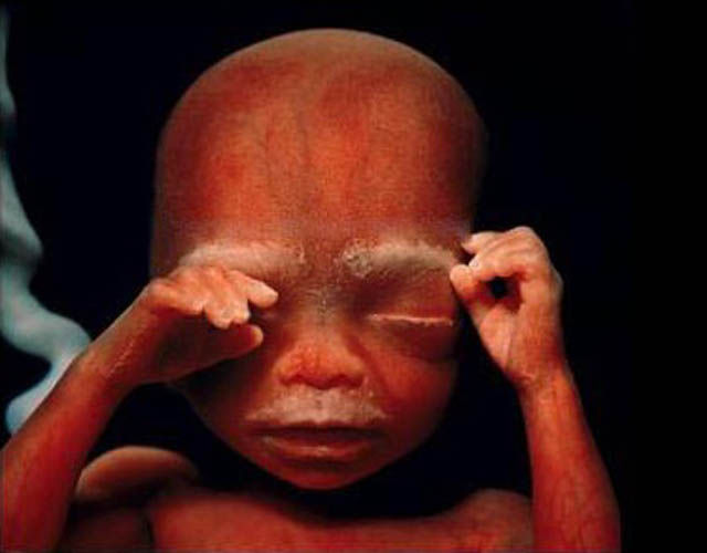 Incredible Photos: A Child is Born