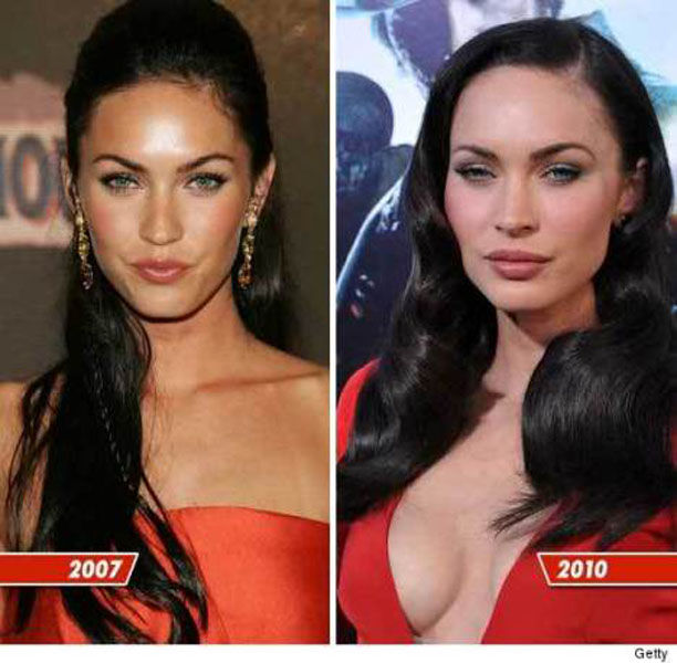 Celebrity Plastic Surgery Before After Pics Izismile Com