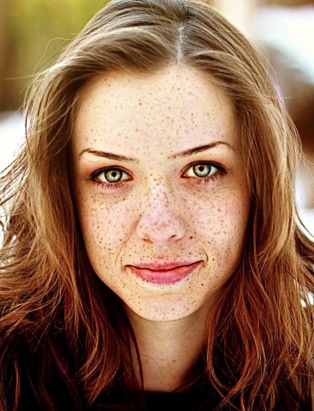 Freckles to the Front Please (33 pics) - Izismile.com