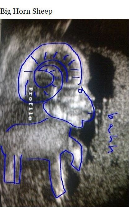 Uncanny Ultrasound Pictures