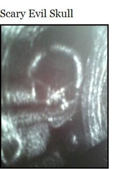 Uncanny Ultrasound Pictures