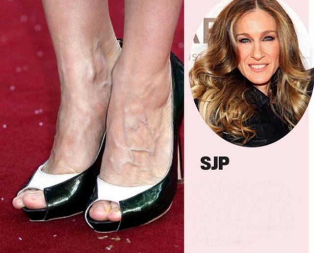 Attractive Celebs Have Completely Unattractive Feet