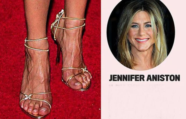 Attractive Celebs Have Completely Unattractive Feet