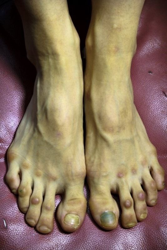 The Feet of Professional Ballet Dancer
