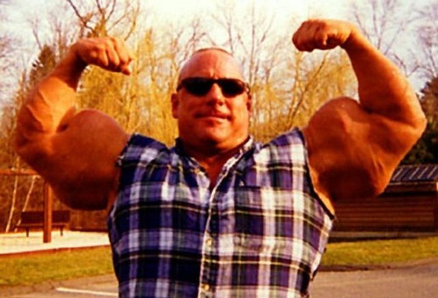 Another Synthol Victim