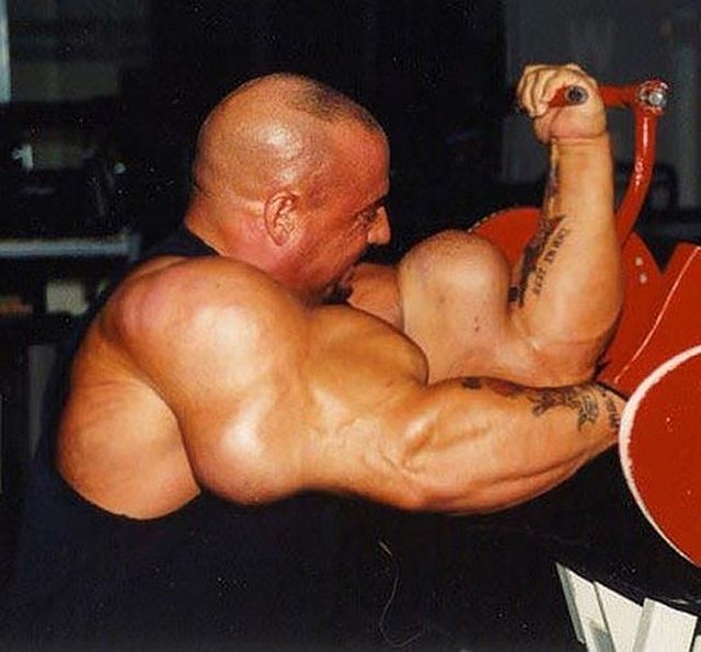 Another Synthol Victim