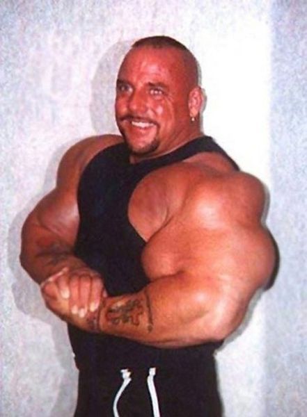 Another Synthol Victim