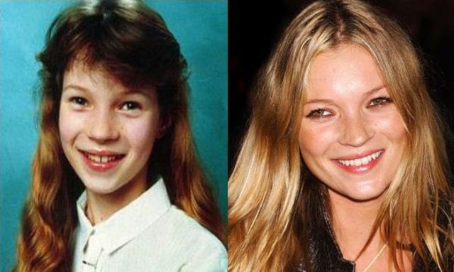 Did Supermodels Look Good In Their Yearbook Photos?