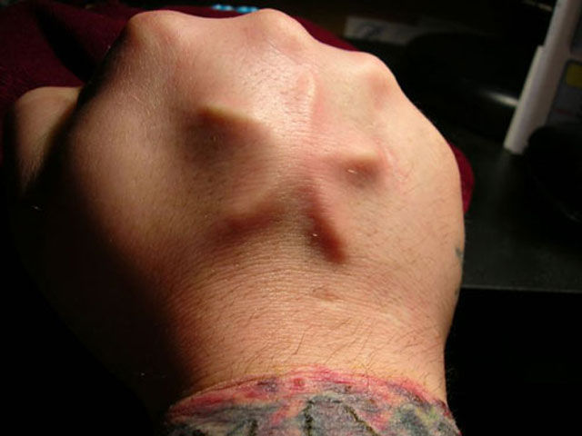 Going Deep: Under the Skin Body Modification