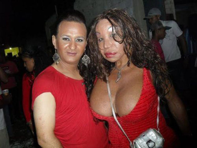 When Plastic Surgery Goes Really Wrong