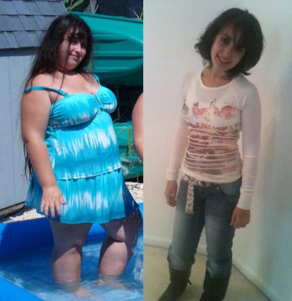 Amazing Weight Loss: Before and After