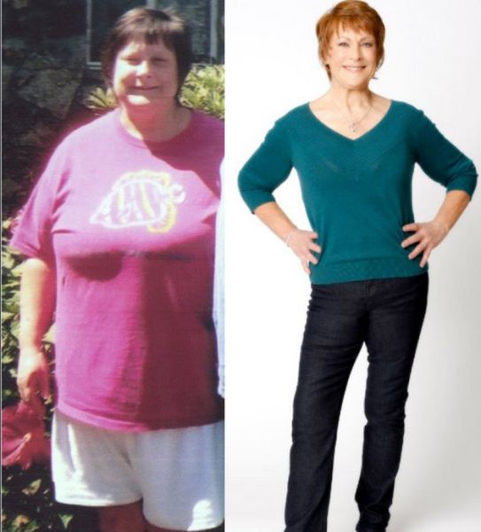 Amazing Weight Loss: Before and After