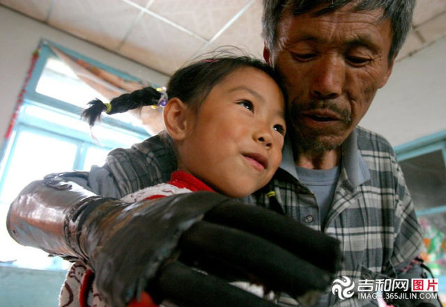 Chinese Man Builds Himself Bionic Hands from Scrap Metal