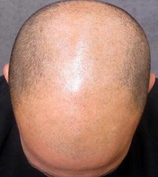 Head People Man Human Cartoon Light Hair Bald  Man Without Hair  Cartoon  Free Transparent PNG Clipart Images Download