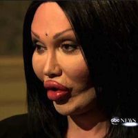 The Horrors of Terrible Plastic Surgery (40 pics) - Picture #12 ...