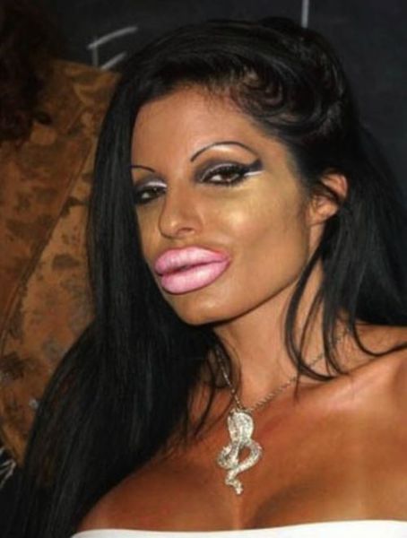The Horrors of Terrible Plastic Surgery